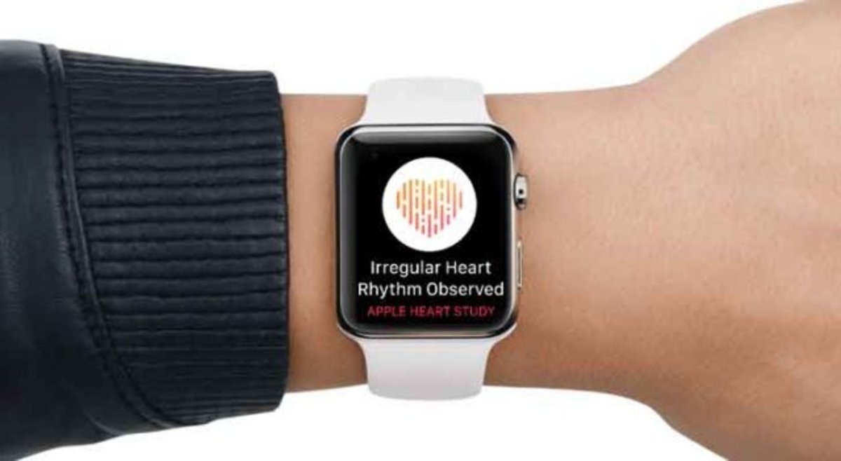 El Apple Watch Series 4 es capaz de hacer electrocardiogramas: ¿Qué significa esto?