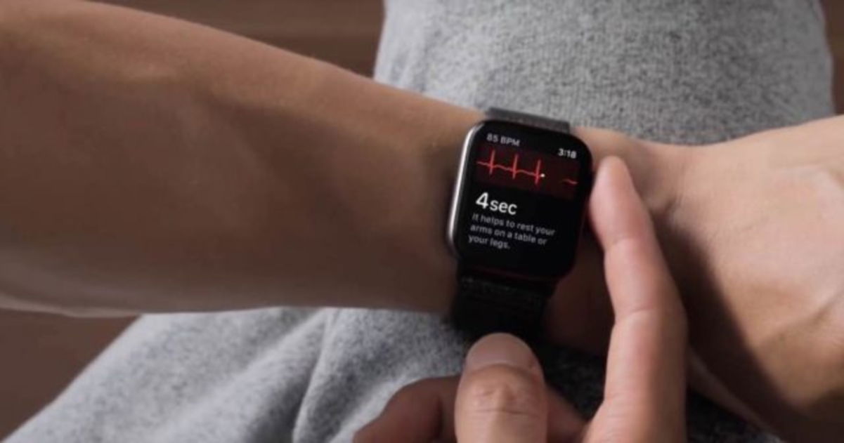 5 cambios que esperamos en el nuevo Apple Watch Series 5
