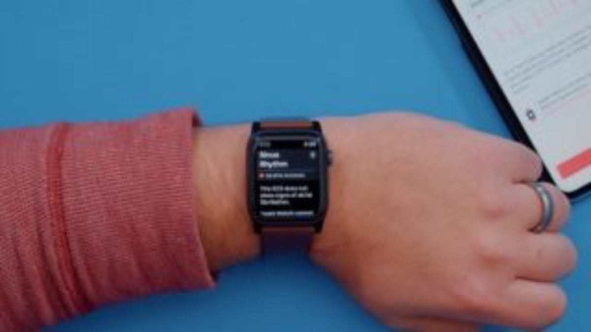 5 cosas que debes saber del ECG del Apple Watch Series 4