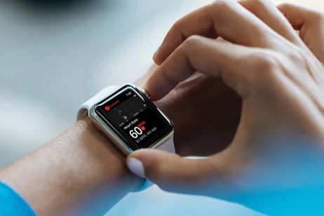 Cómo hacer que el Apple Watch te notifique de un ritmo cardíaco irregular Cómo hacer que el Apple Watch te notifique de un ritmo cardíaco irregular