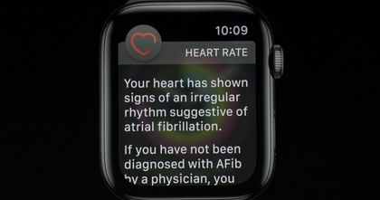 Así salvó el Apple Watch la vida de esta mujer Así salvó el Apple Watch la vida de esta mujer