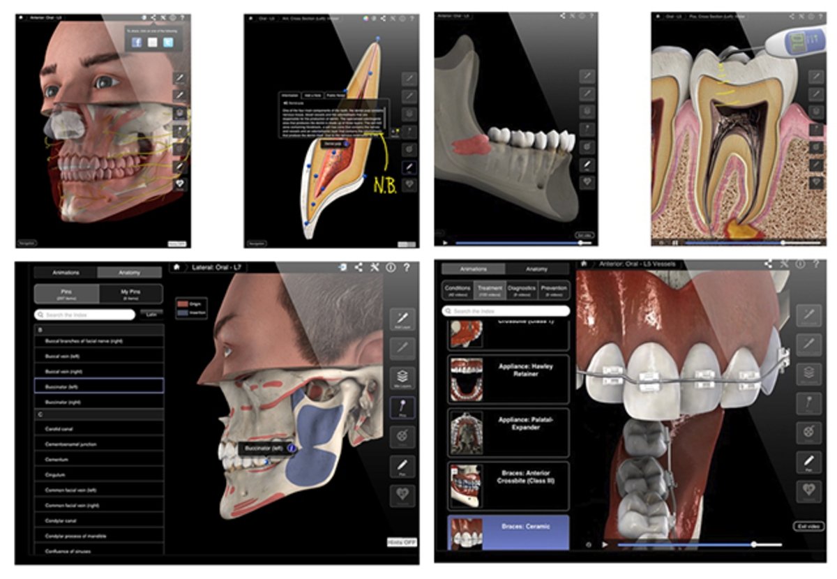 Dental Patient Education: 3D view of the anatomical structures of the teeth