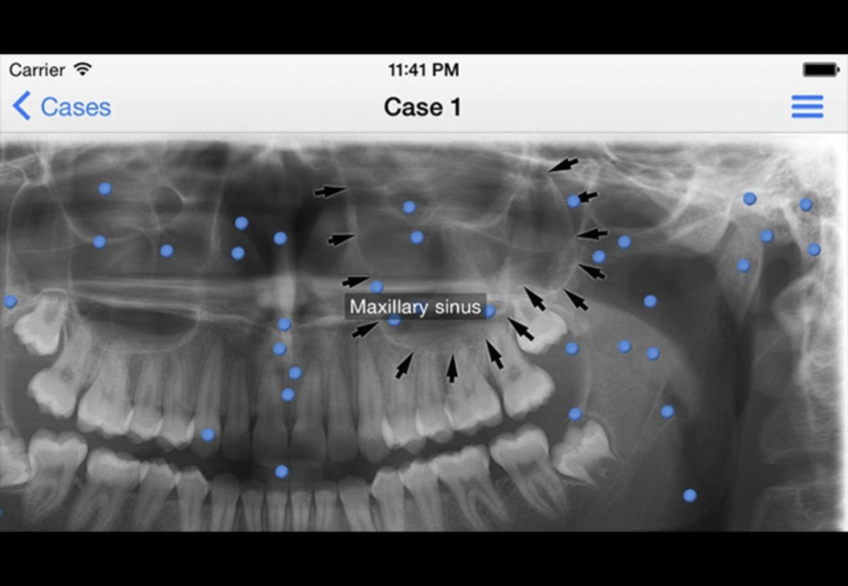 iPanoramic: bony and anatomical structures of the oral cavity