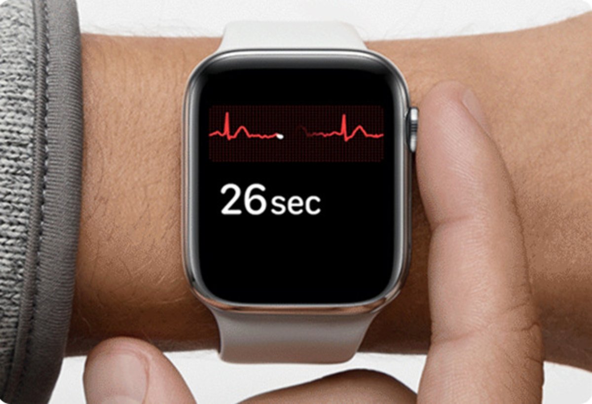 Electrocardiograma Apple Watch