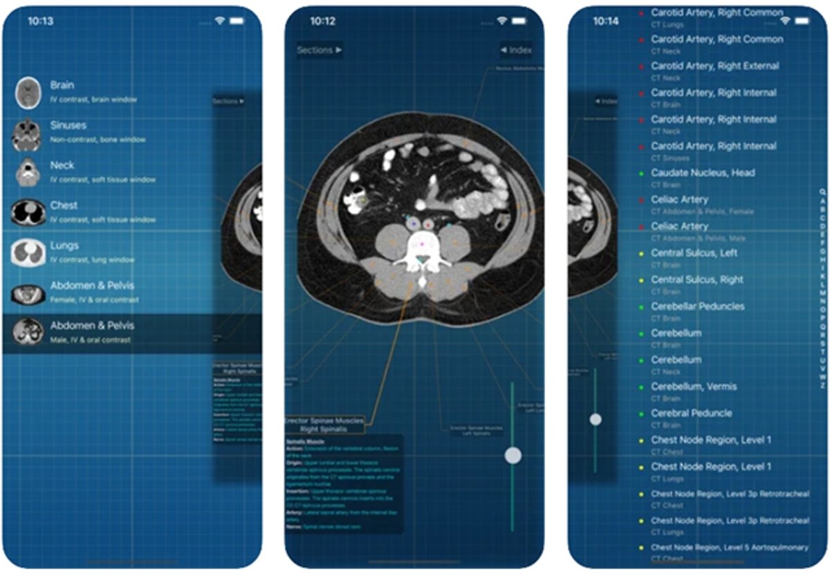 X-Anatomy Pro: biblioteca de imágenes médicas de anatomía humana
