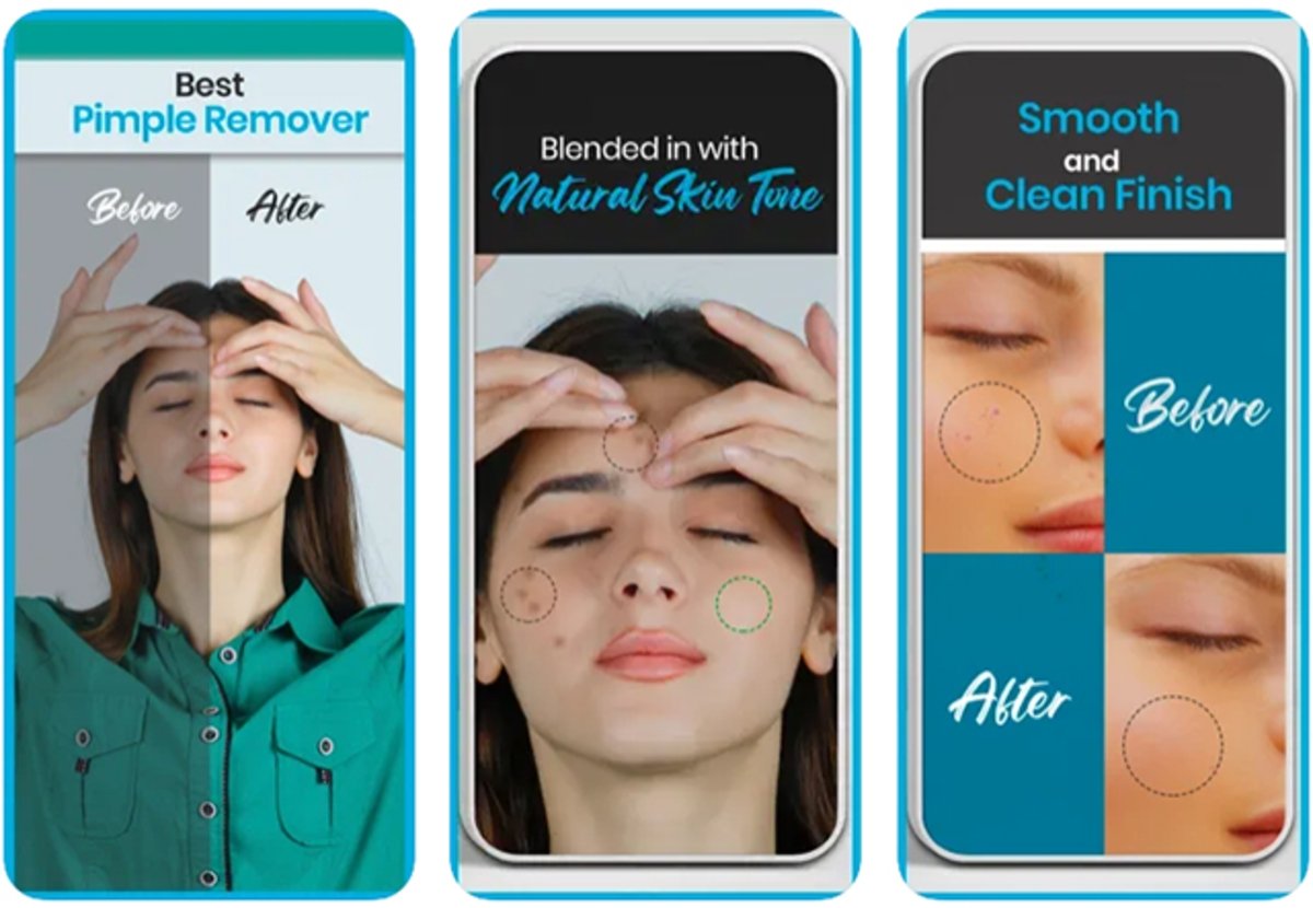Mejores apps para quitar granos y corregir imperfecciones de tu rostro desde iPhone