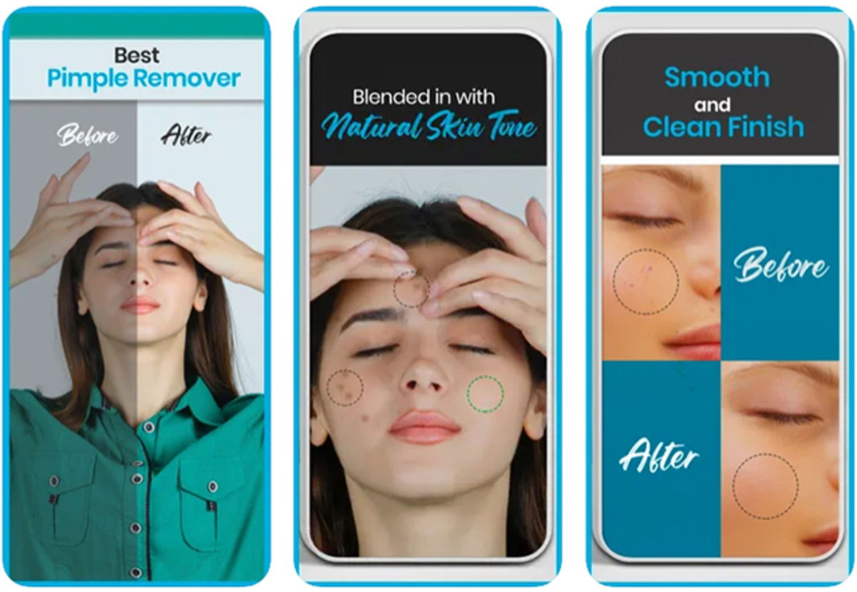 Mejores apps para quitar granos y corregir imperfecciones de tu rostro