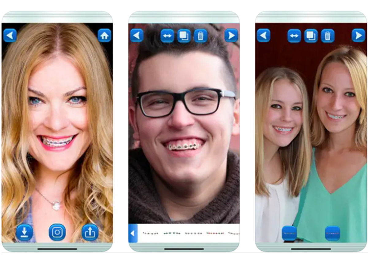 The Best Braces Simulator Apps Available For IPhone GEARRICE
