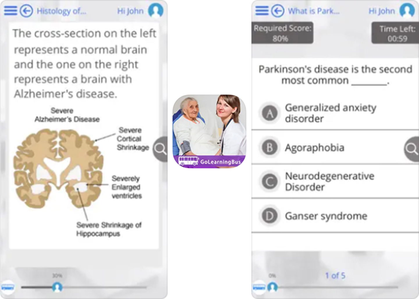 GoLearningBus - tu viaje hacia la comprension de Alzheimer y Parkinson