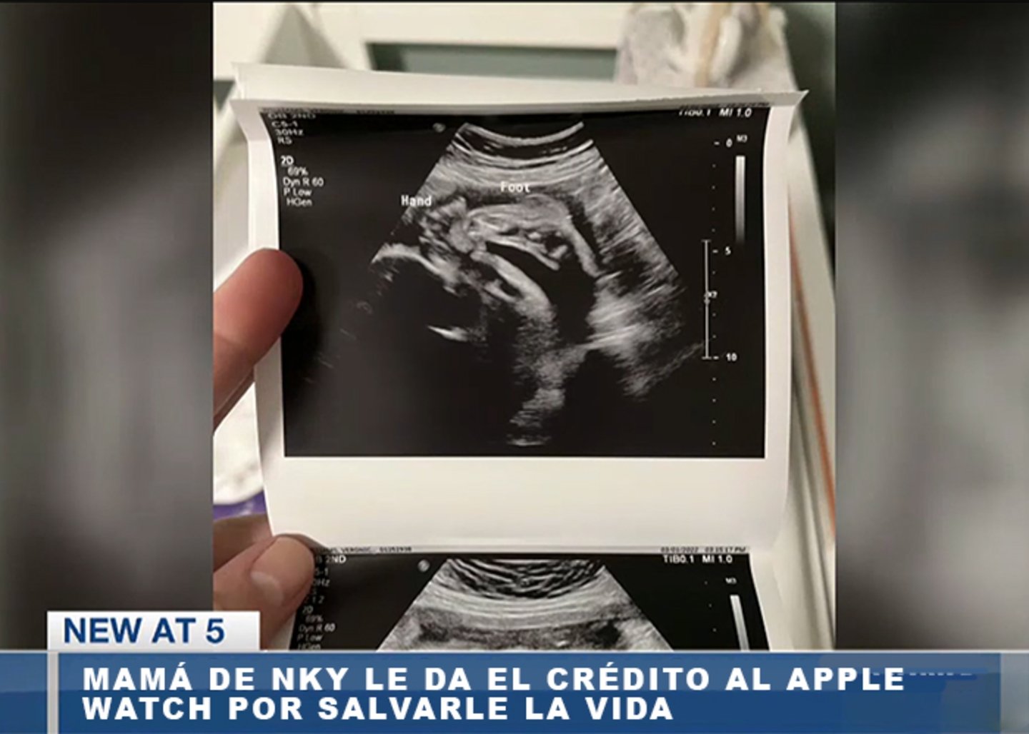 Apple Watch salva la vida de una mujer embarazada y su bebe