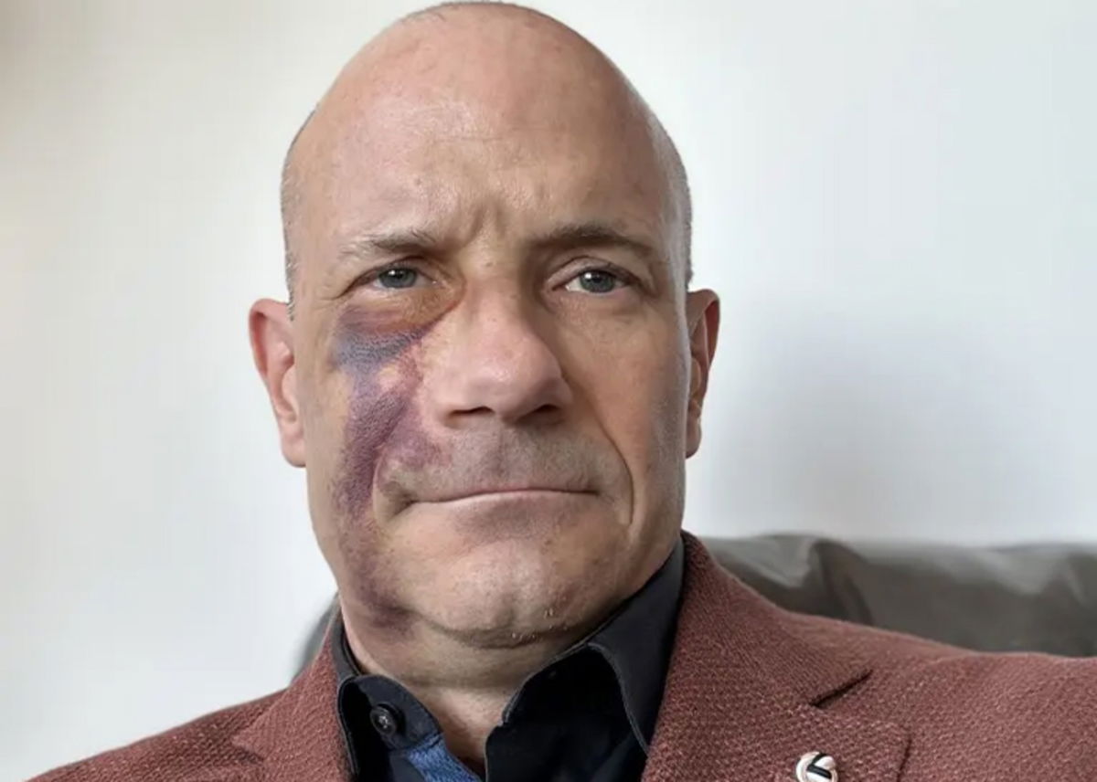 Apple Watch Fall Detection Helps Rescue Cyclist After Bad Accident GEARRICE